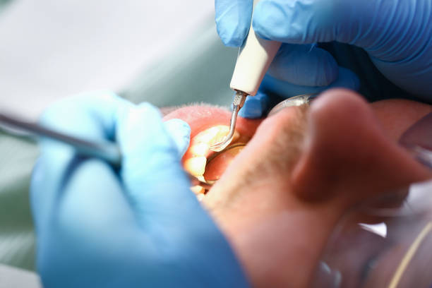 Best Emergency Dental Filling Replacement  in Annandale, MN